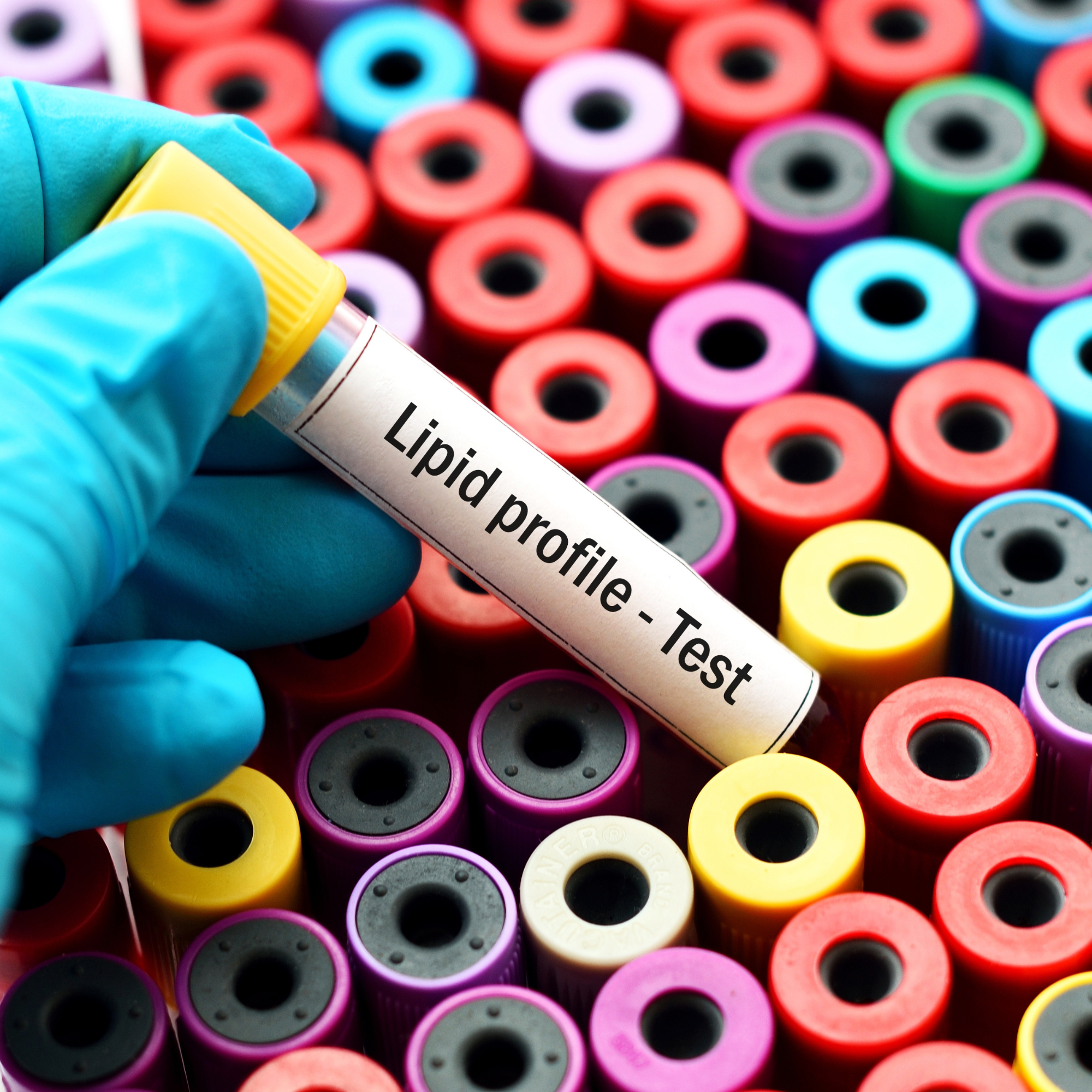 Lipid Metabolism