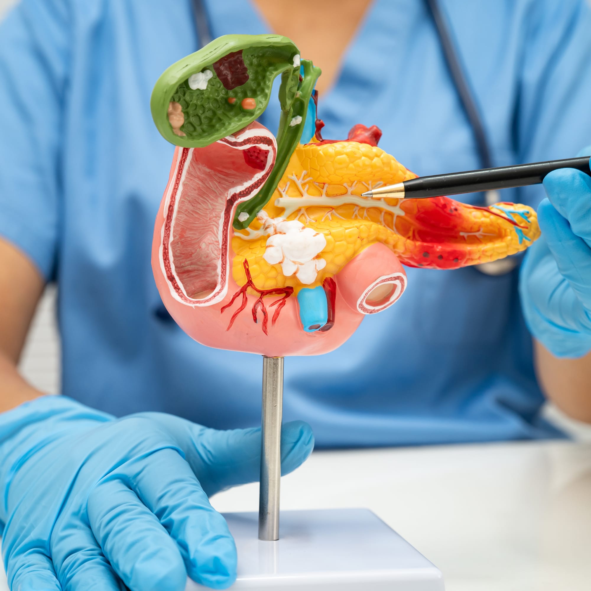 Pancreatic Support